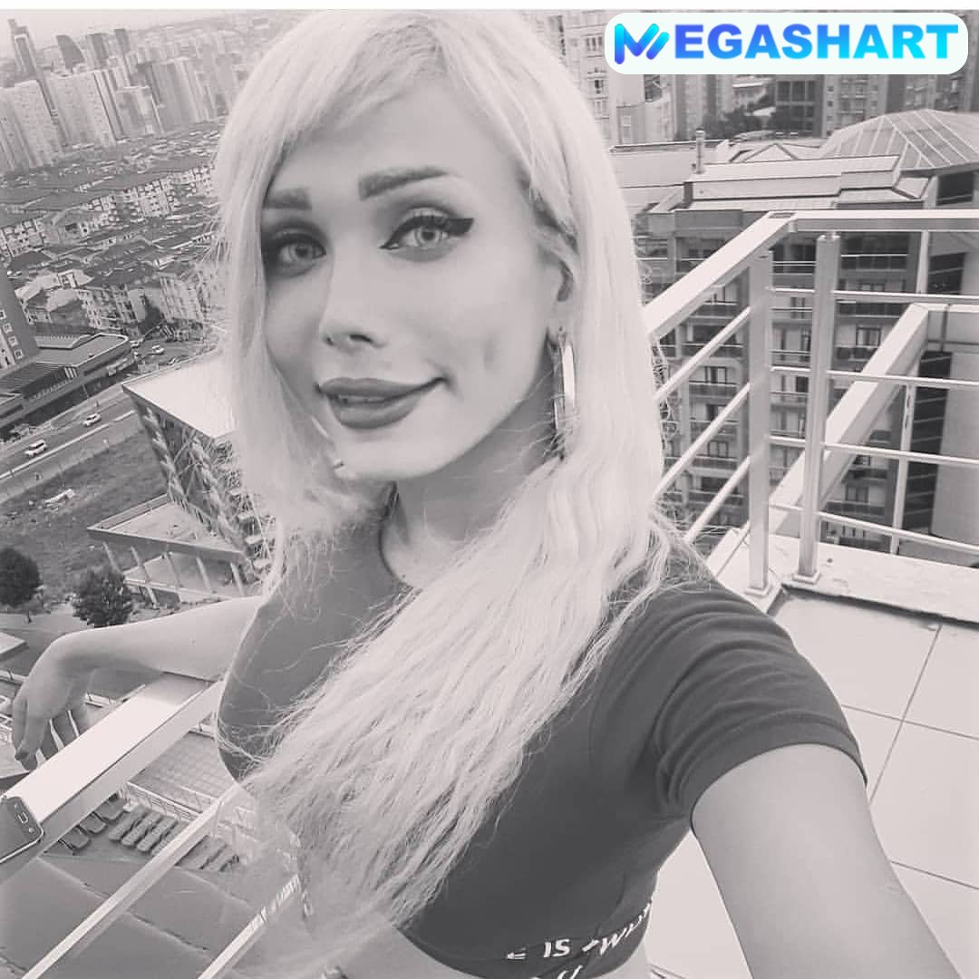 دیانا دادمهر قبل از عمل